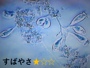 エピスティリス